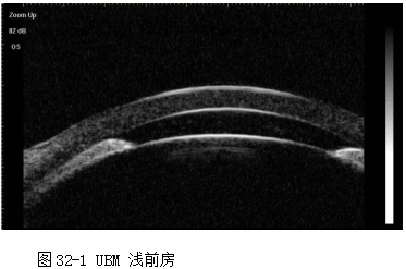 ZY016_164_2.gif